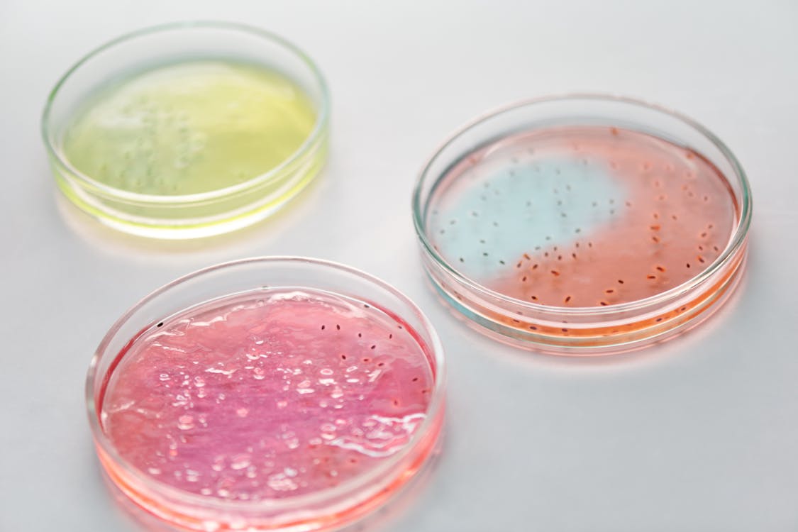 Colorful petri dishes with bacterial cultures arranged on a laboratory surface for microbiome analysis